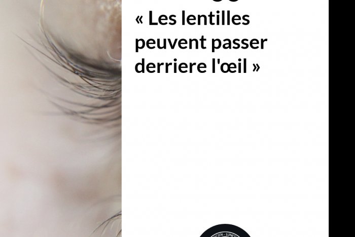 Les lentilles peuvent passer derrière l&#039;oeil