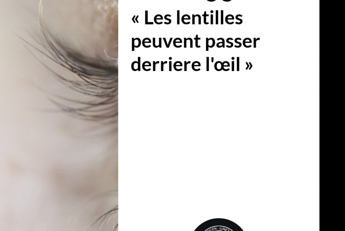 Les lentilles peuvent passer derrière l'oeil